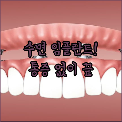 치과 진료 부담 덜어주는 수면 임플란트의 효과와 시술 과정